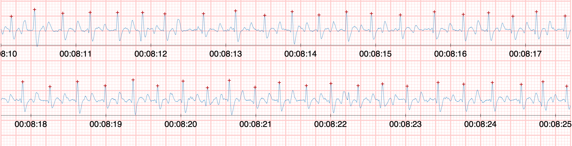 ECG arioneo (1)