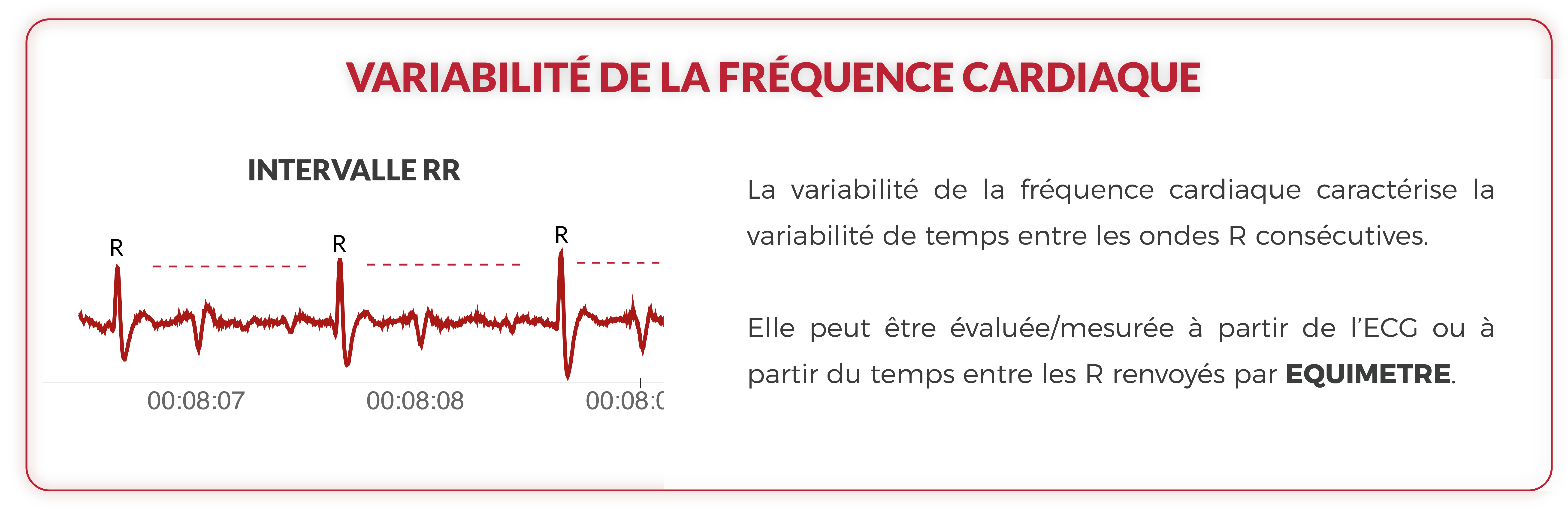 infographie sur la variabilité cardiaque chez le cheval de course avec un exemple d'ecg