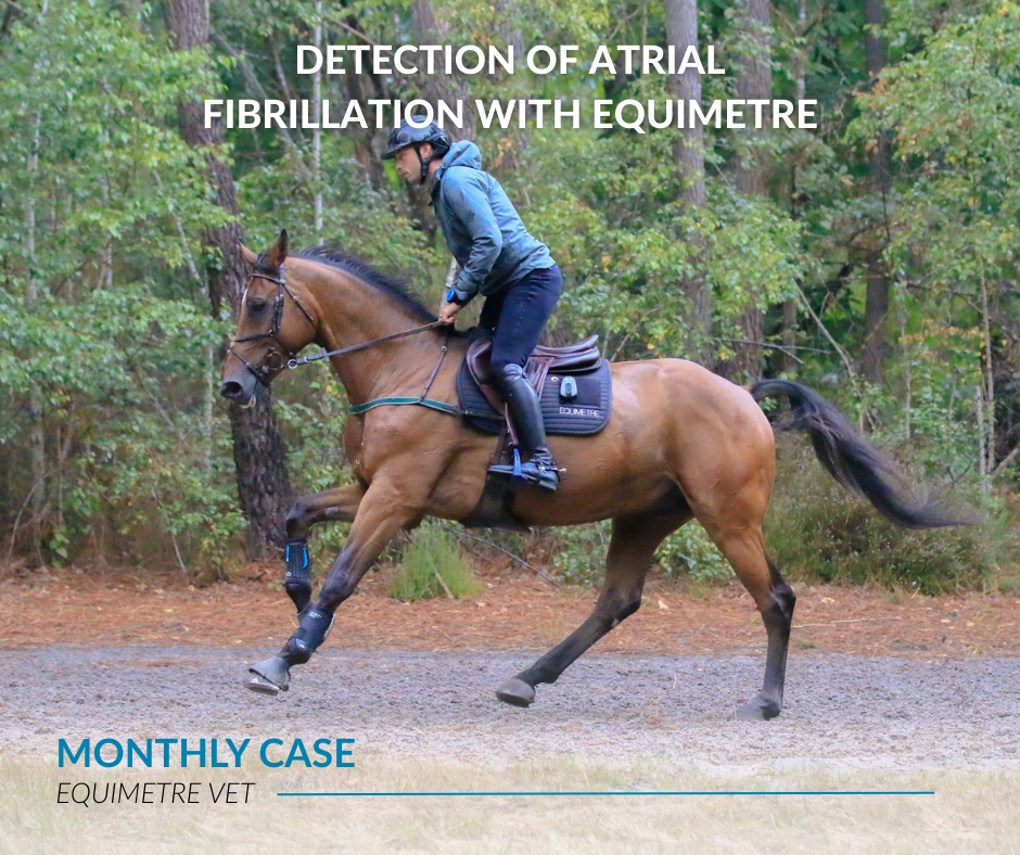 montly case atrial fibrillation